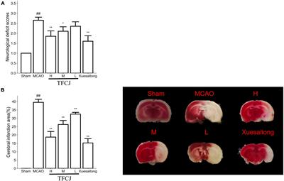 Total Flavonoids of Chuju Decrease Oxidative Stress and Cell Apoptosis in Ischemic Stroke Rats: Network and Experimental Analyses